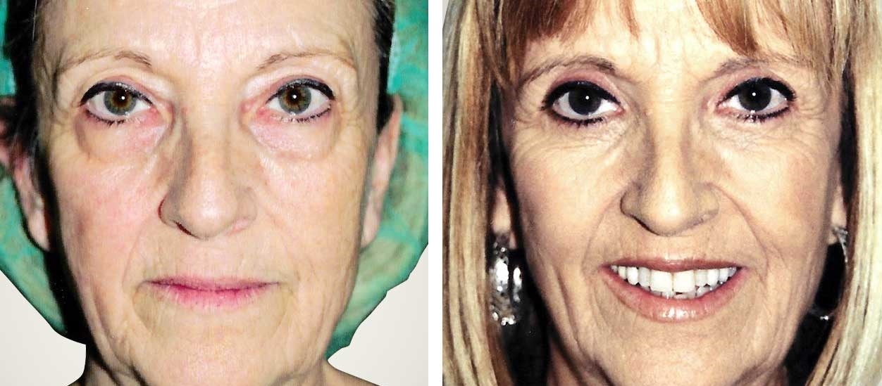 Crema antibolsas y ojeras + colágeno